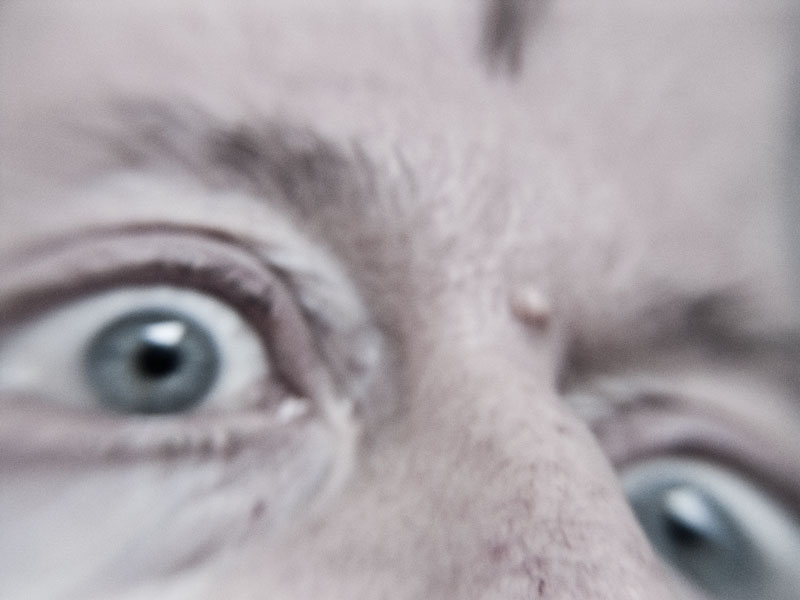 Augen auf Werner